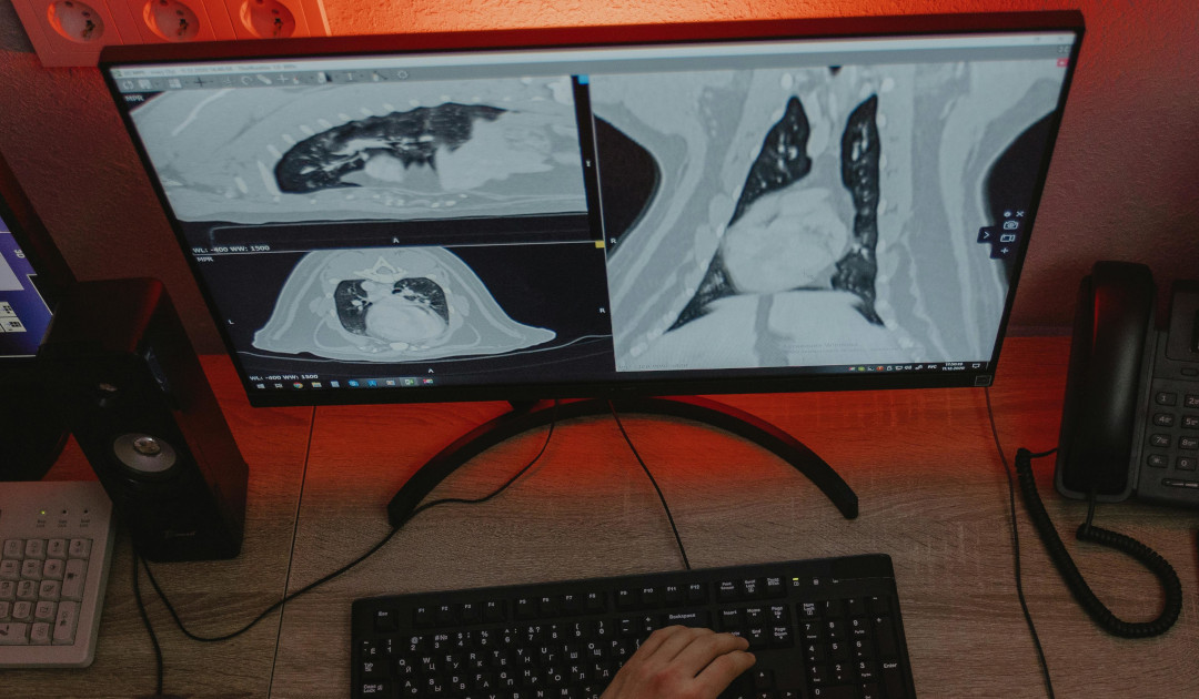 hands-scan-keyboard_1080x630